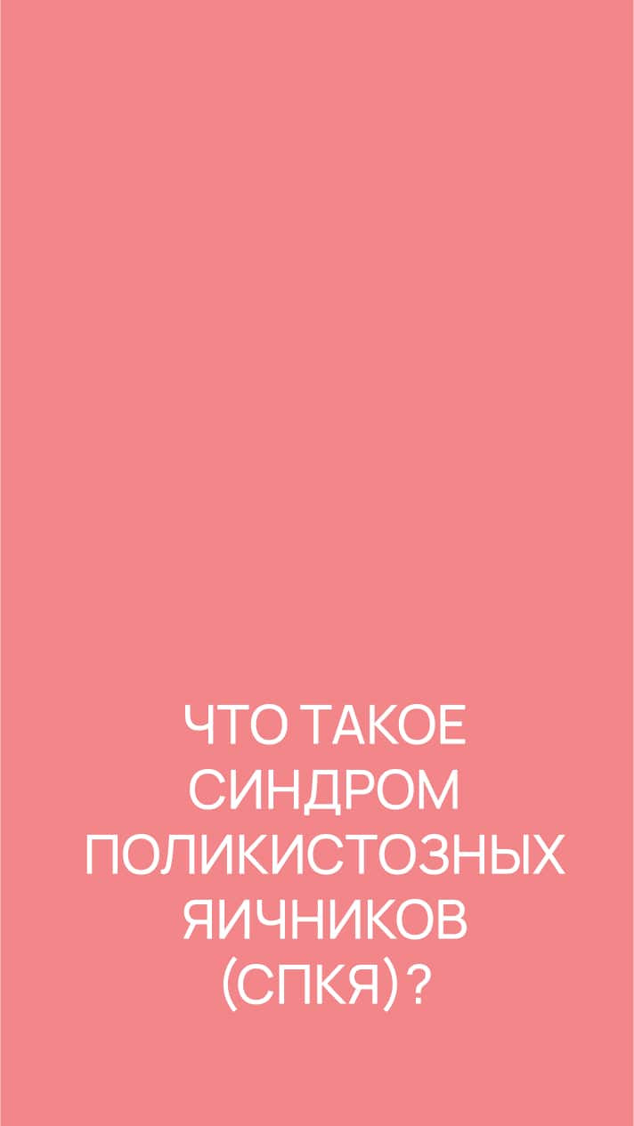 Что такое синдром поликистозных яичников (СПКЯ)?
